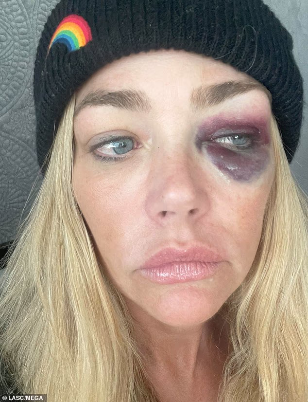 Richards Claiming Domestic Abuse Against Her Husband In The Ongoing Divorce Case Photocredit Getty Images