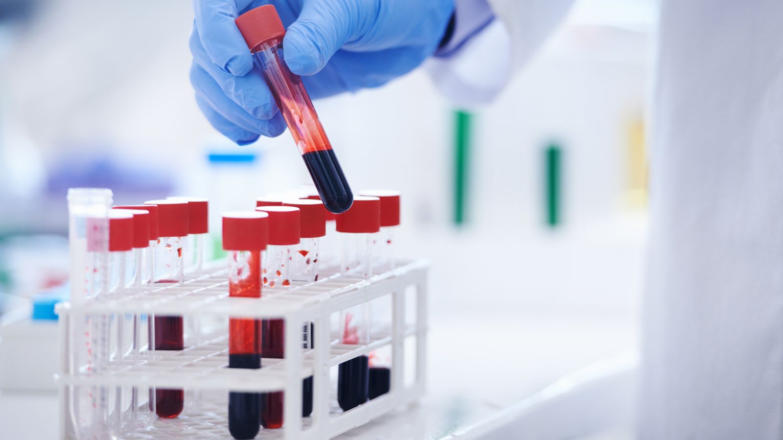 Blood Test Generic In A Lab